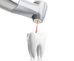 dent1